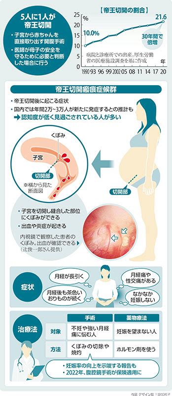 セックス嘔吐|セックス後の不調、オーガズム後症候群って知っていますか？。